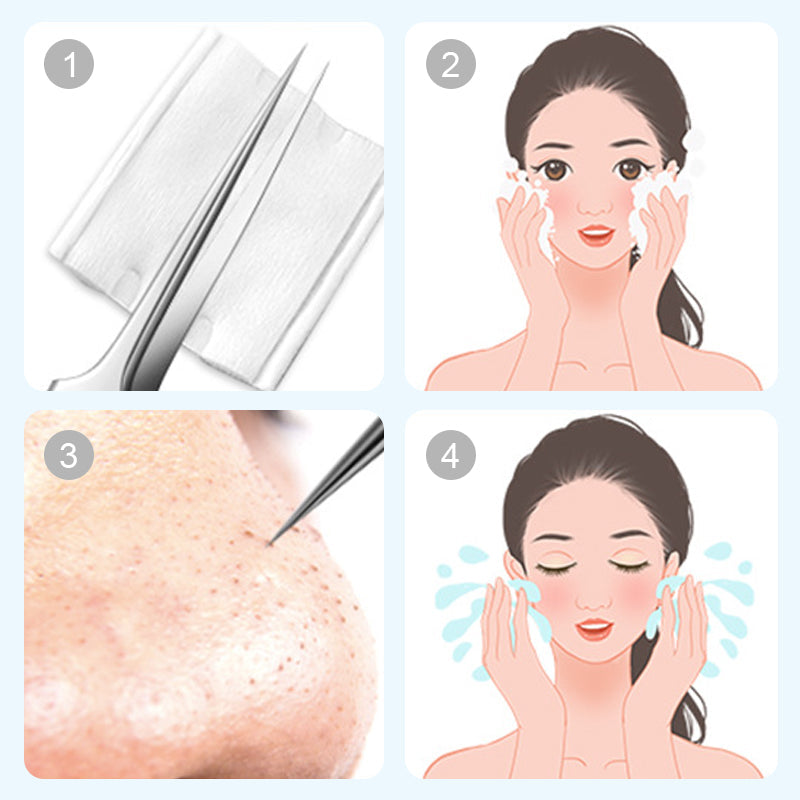 💓2025 HOT SALE 50% OFF💥Medical Grade Blackhead Extraction Tool Kit